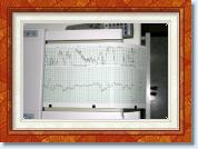 150305_1 * cardiotocography CTG * 841 x 561 * (152KB)